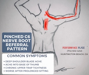 Infraspinatus Strain Treatments, Therapy and Hope!