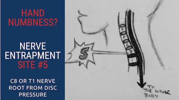 Top 5 Ulnar Nerve Entrapment Locations & Treatments