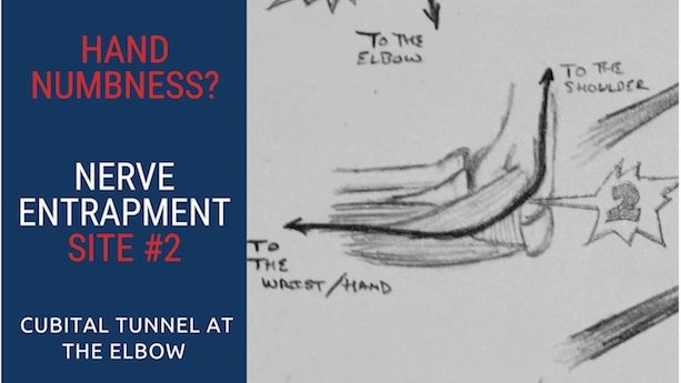 Top 5 Ulnar Nerve Entrapment Locations & Treatments