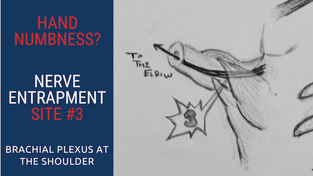 Top 5 Ulnar Nerve Entrapment Locations & Treatments