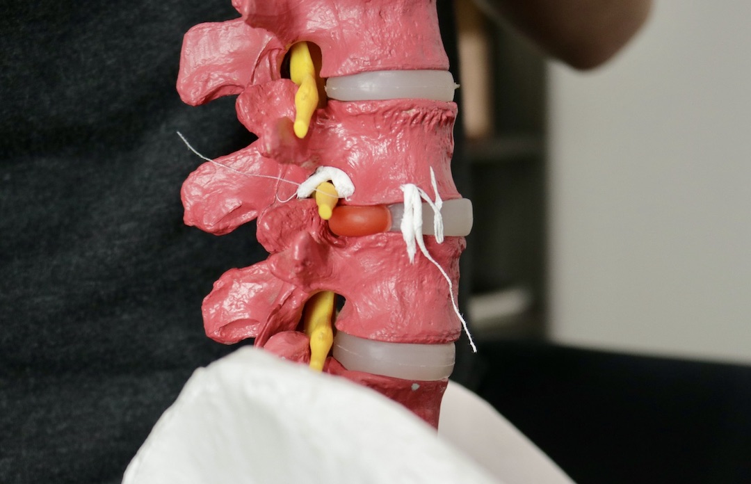 Pressure in Lower Back: How To Relieve Pain For Good [2021]