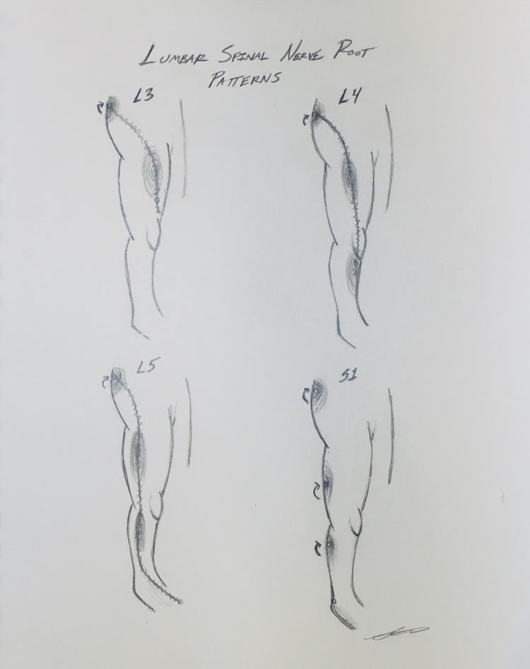 Piriformis Syndrome Case Study With Positive Results in Three Days