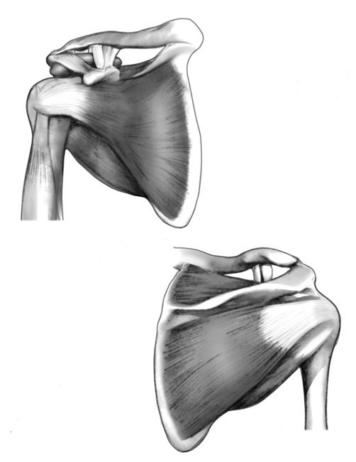 Rotator Cuff Shoulder Pain: Impingement, Tears and Referred Pain [2021]