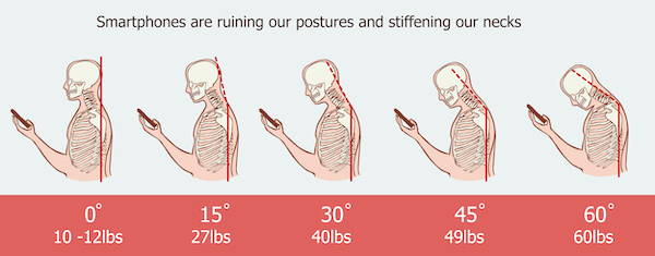 Nerd Neck: 5 Ways To Fix It [2021 Update]