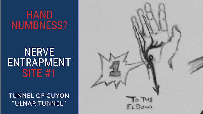 Top 5 Ulnar Nerve Entrapment Locations & Treatments